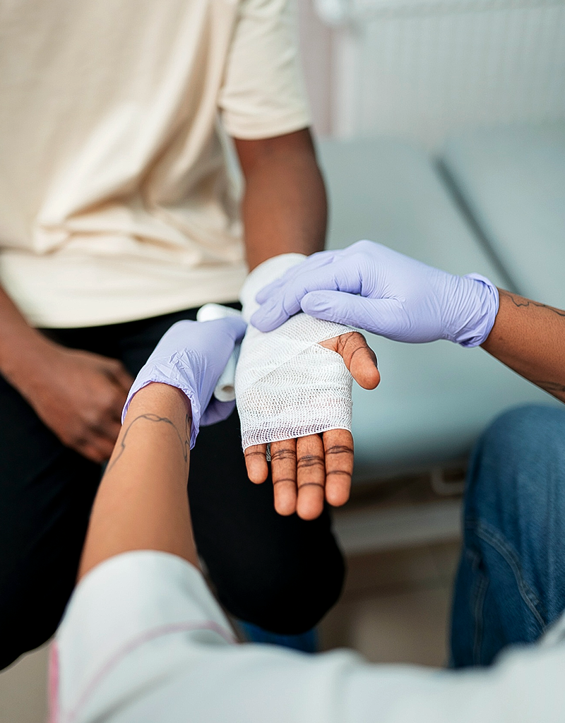 Treatment by Sprain