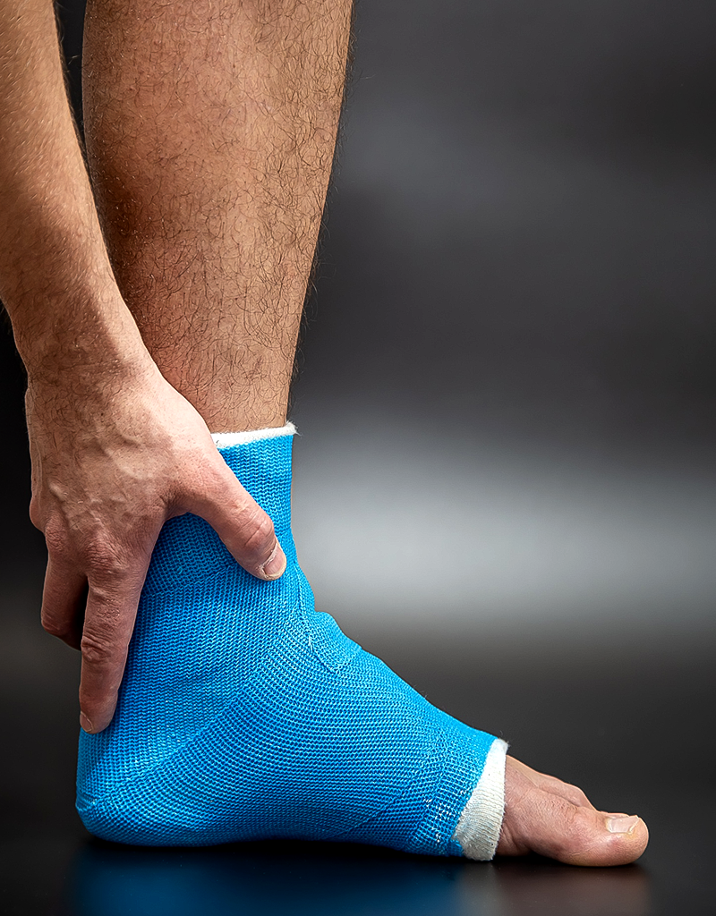 What is a Sprain