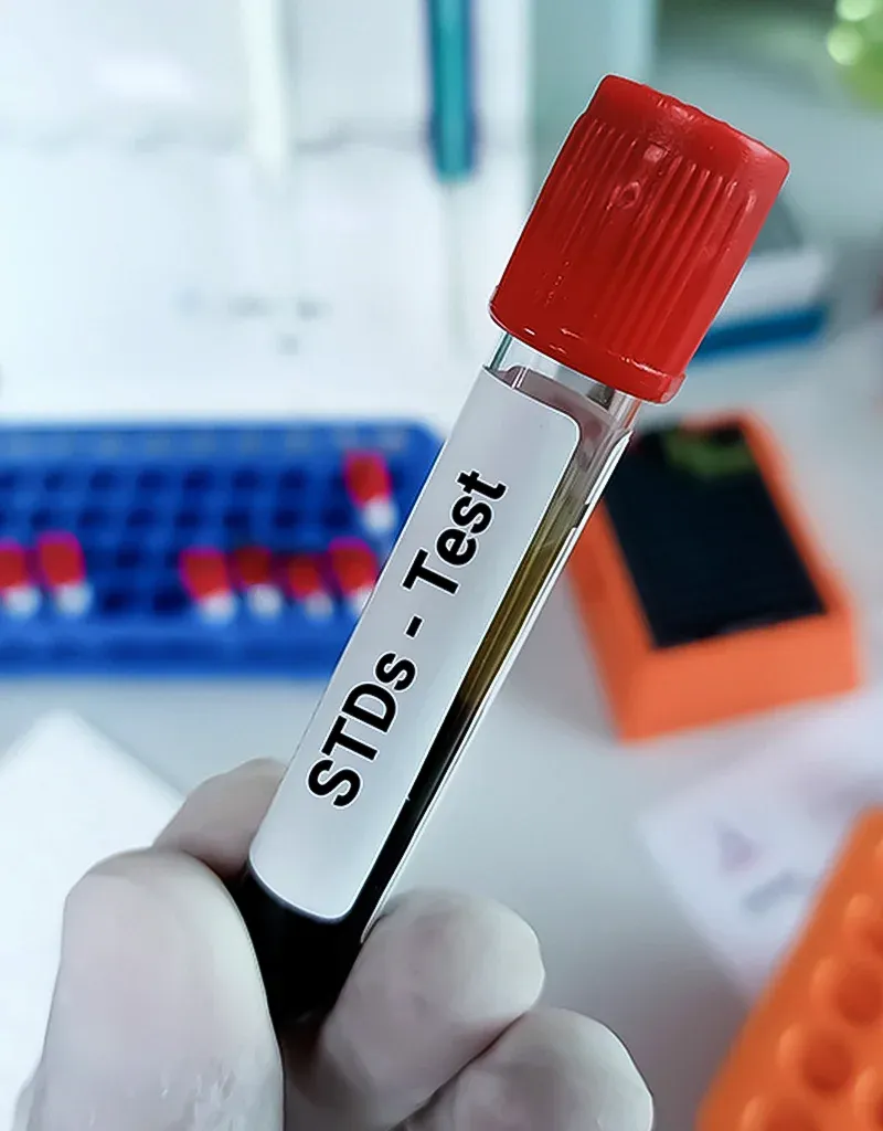 imgi_100_What-is-STD-Testing