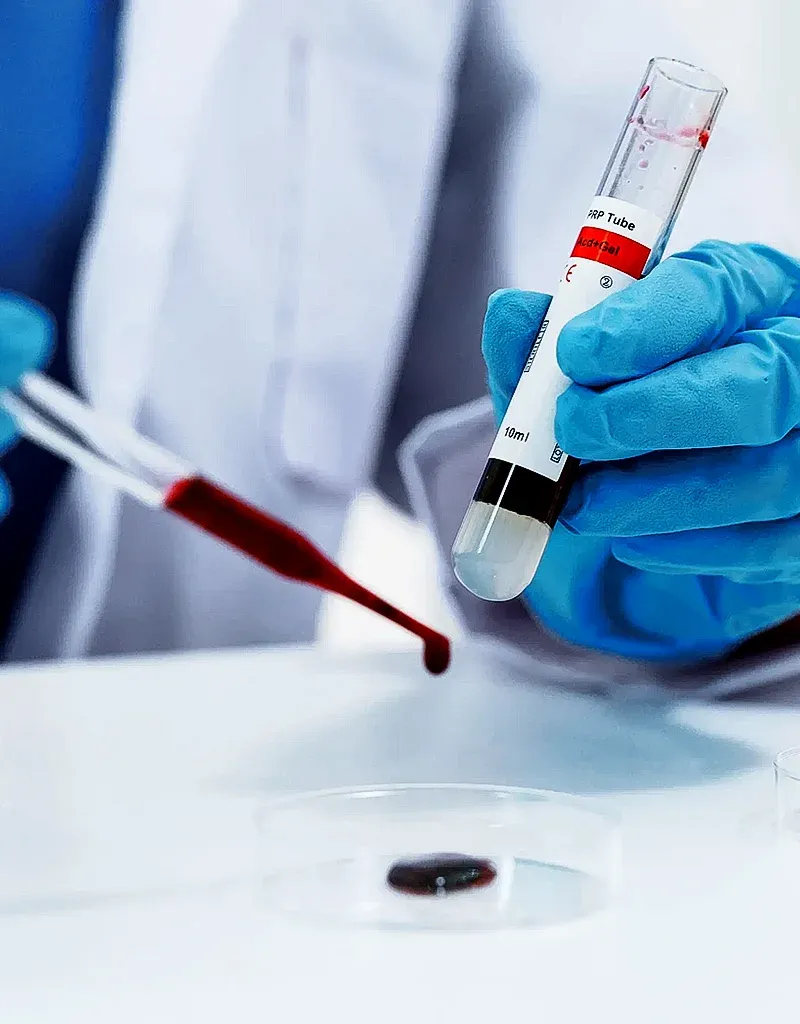 Lab Testing
